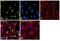 Protein Arginine Methyltransferase 1 antibody, PA5-17299, Invitrogen Antibodies, Immunofluorescence image 