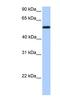 UDP Glucuronosyltransferase Family 2 Member A3 antibody, NBP1-62332, Novus Biologicals, Western Blot image 