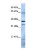 Polycomb Group Ring Finger 5 antibody, NBP1-55283, Novus Biologicals, Western Blot image 
