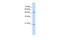 Glucosaminyl (N-Acetyl) Transferase 4 antibody, A16200, Boster Biological Technology, Western Blot image 