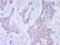 Mucin 16, Cell Surface Associated antibody, orb414535, Biorbyt, Immunohistochemistry paraffin image 