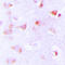 Acetyl-CoA Carboxylase Alpha antibody, LS-C354516, Lifespan Biosciences, Immunohistochemistry frozen image 