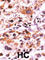 Fibroblast Growth Factor Receptor 1 antibody, abx031862, Abbexa, Western Blot image 