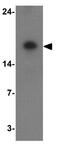 ADP Ribosylation Factor 6 antibody, GTX31908, GeneTex, Western Blot image 