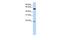 Acy1l2 antibody, GTX45840, GeneTex, Western Blot image 