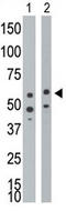 Bone morphogenetic protein receptor type-1A antibody, AP11858PU-N, Origene, Western Blot image 