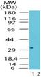 Interferon-inducible double stranded RNA-dependent protein kinase activator A antibody, NB100-56467, Novus Biologicals, Western Blot image 