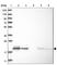 Solute Carrier Family 25 Member 10 antibody, HPA022853, Atlas Antibodies, Western Blot image 