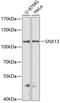 Sorting Nexin 13 antibody, GTX66121, GeneTex, Western Blot image 