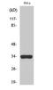 Olfactory Receptor Family 52 Subfamily W Member 1 antibody, A16889, Boster Biological Technology, Western Blot image 