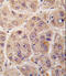 Pim-3 Proto-Oncogene, Serine/Threonine Kinase antibody, 62-703, ProSci, Immunohistochemistry paraffin image 