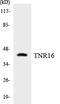 Nerve Growth Factor Receptor antibody, EKC1672, Boster Biological Technology, Western Blot image 