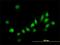 Antioxidant 1 Copper Chaperone antibody, H00000475-M01, Novus Biologicals, Immunofluorescence image 