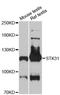 Serine/Threonine Kinase 31 antibody, LS-C748167, Lifespan Biosciences, Western Blot image 
