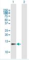 Cyclin Dependent Kinase 2 Associated Protein 1 antibody, H00008099-B01P-50ug, Novus Biologicals, Western Blot image 