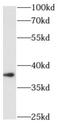 ALX Homeobox 1 antibody, FNab00352, FineTest, Western Blot image 