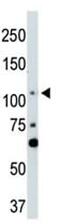 Large Tumor Suppressor Kinase 2 antibody, ab135794, Abcam, Western Blot image 