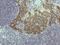 Keratin 5 antibody, M00398-3, Boster Biological Technology, Immunohistochemistry frozen image 
