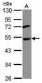 DEP Domain Containing MTOR Interacting Protein antibody, PA5-30738, Invitrogen Antibodies, Western Blot image 