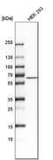 Tryptophan Hydroxylase 1 antibody, HPA022483, Atlas Antibodies, Western Blot image 