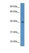 ELMO Domain Containing 3 antibody, NBP1-79821, Novus Biologicals, Western Blot image 