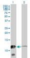 Myotrophin antibody, MA5-24520, Invitrogen Antibodies, Western Blot image 