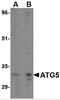 Autophagy Related 5 antibody, 4441, ProSci, Western Blot image 