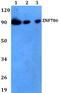 Zinc Finger Protein 786 antibody, A16420, Boster Biological Technology, Western Blot image 