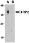 C1q And TNF Related 2 antibody, orb74634, Biorbyt, Western Blot image 