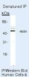 Actin Gamma 2, Smooth Muscle antibody, NB600-535, Novus Biologicals, Immunoprecipitation image 