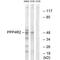 Protein Phosphatase 4 Regulatory Subunit 2 antibody, PA5-50130, Invitrogen Antibodies, Western Blot image 