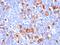 Fascin Actin-Bundling Protein 1 antibody, MBS439383, MyBioSource, Immunohistochemistry frozen image 