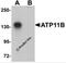 ATPase Phospholipid Transporting 11B (Putative) antibody, 5857, ProSci Inc, Western Blot image 