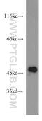 Isocitrate Dehydrogenase (NADP(+)) 1, Cytosolic antibody, 23309-1-AP, Proteintech Group, Western Blot image 
