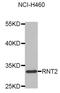 Ribonuclease T2 antibody, STJ29655, St John