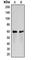 Colony Stimulating Factor 2 Receptor Alpha Subunit antibody, abx121928, Abbexa, Western Blot image 