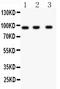 Neural Precursor Cell Expressed, Developmentally Down-Regulated 9 antibody, PB9289, Boster Biological Technology, Western Blot image 