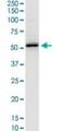 Serpin Family H Member 1 antibody, H00000871-M01, Novus Biologicals, Western Blot image 