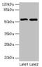 STEAP3 Metalloreductase antibody, CSB-PA717655LA01HU, Cusabio, Western Blot image 