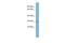 ARV1 Homolog, Fatty Acid Homeostasis Modulator antibody, A10363, Boster Biological Technology, Western Blot image 