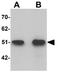 Solute Carrier Family 39 Member 9 antibody, GTX31817, GeneTex, Western Blot image 