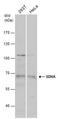 Succinate Dehydrogenase Complex Flavoprotein Subunit A antibody, GTX101689, GeneTex, Western Blot image 