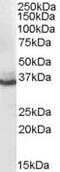 Aldo-Keto Reductase Family 1 Member C4 antibody, MBS421331, MyBioSource, Western Blot image 