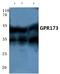 Probable G-protein coupled receptor 173 antibody, A14126Y289, Boster Biological Technology, Western Blot image 