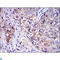 Interleukin 1 Receptor Associated Kinase 4 antibody, LS-C812660, Lifespan Biosciences, Immunohistochemistry paraffin image 