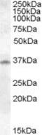 Cathepsin K antibody, PA5-18950, Invitrogen Antibodies, Western Blot image 