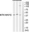 Thymidine Kinase 1 antibody, TA312764, Origene, Western Blot image 