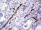 Melanoma Cell Adhesion Molecule antibody, LS-C796879, Lifespan Biosciences, Immunohistochemistry paraffin image 