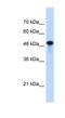 Septin 10 antibody, NBP1-58106, Novus Biologicals, Western Blot image 