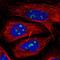 Zinc Finger Protein 142 antibody, NBP2-13554, Novus Biologicals, Immunofluorescence image 